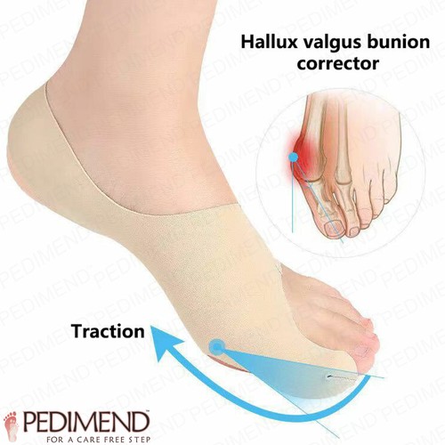 Pedimend bunion corrector - pedimend,