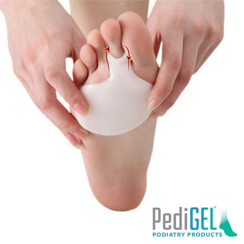 Gel metatarsal pads - gel, /